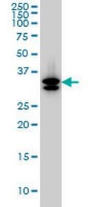 SULT1A3 Monoclonal Antibody (1B10)