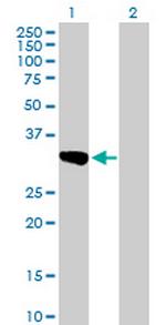 SULT1C1 Polyclonal Antibody, MaxPab™