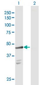 SULT2B1 Polyclonal Antibody, MaxPab™