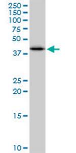 SULT2B1 Monoclonal Antibody (2E5)