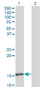 SUPT4H1 Antibody in Western Blot (WB)