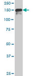SUPT5H Monoclonal Antibody (3F1)