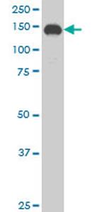 SUPT5H Antibody in Western Blot (WB)