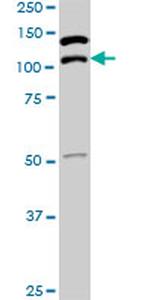 SUPT5H Antibody in Western Blot (WB)