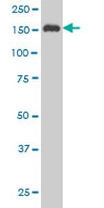 SUPT5H Antibody in Western Blot (WB)