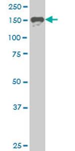 SUPT5H Antibody in Western Blot (WB)