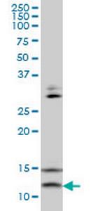 VAMP1 Antibody in Western Blot (WB)
