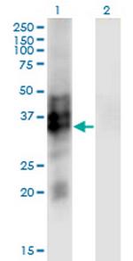SYP Monoclonal Antibody (3B3)