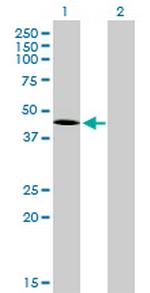 T Monoclonal Antibody (5H8)