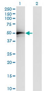 TADA2L Monoclonal Antibody (4A8-1A7)