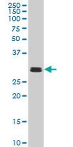 TAF11 Monoclonal Antibody (2G9)