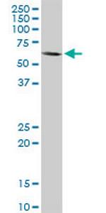 MAP3K7 Antibody in Western Blot (WB)
