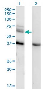 MAP3K7 Monoclonal Antibody (3C9)
