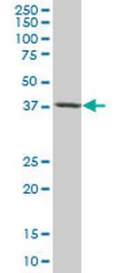 TARBP2 Antibody in Western Blot (WB)