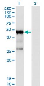 TARBP2 Monoclonal Antibody (1D9)