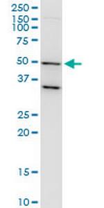 TARBP2 Monoclonal Antibody (2G10)