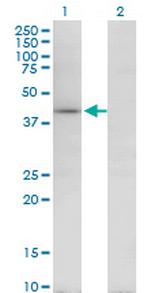 TARBP2 Monoclonal Antibody (1G6)