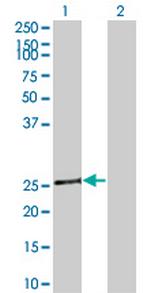 TAZ Monoclonal Antibody (1F9)