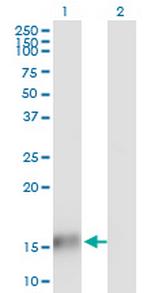 TBCA Monoclonal Antibody (1D2)