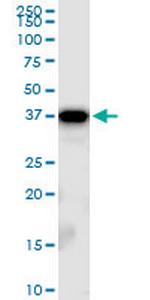 TBCC Antibody in Western Blot (WB)