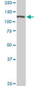 TBCD Polyclonal Antibody, MaxPab™
