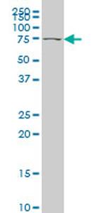 TBX2 Antibody in Western Blot (WB)