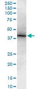TBX6 Monoclonal Antibody (3F11)