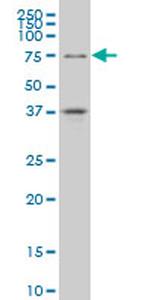 TCF4 Antibody in Western Blot (WB)