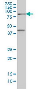 TCF4 Monoclonal Antibody (1F6)