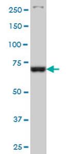 TBX3 Antibody in Western Blot (WB)