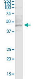 HNF1A Monoclonal Antibody (6G4)