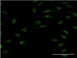 TCF2 Monoclonal Antibody (3H4)