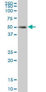 TCF2 Monoclonal Antibody (3E11)