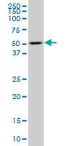 TCF2 Monoclonal Antibody (2F7)