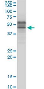 TCF7 Monoclonal Antibody (1B3)
