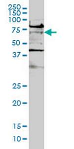 TCF7L2 Monoclonal Antibody (1B1)