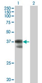 C2orf3 Polyclonal Antibody, MaxPab™