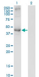 TCN2 Monoclonal Antibody (2F4)