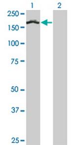 TCOF1 Monoclonal Antibody (8H3)