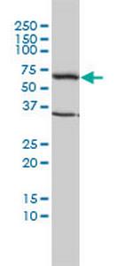 TCP1 Monoclonal Antibody (2B2-D6)