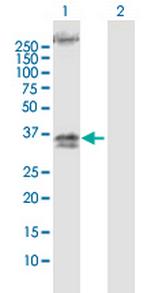 TRA Antibody in Western Blot (WB)