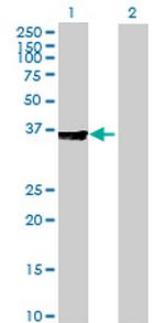 TRA Antibody in Western Blot (WB)