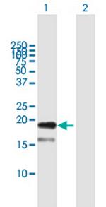 TDGF1 Polyclonal Antibody, MaxPab™