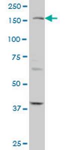 TEK Monoclonal Antibody (3F8)