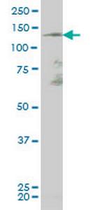 TEK Monoclonal Antibody (2D2)