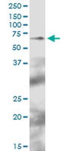 TFCP2 Antibody in Western Blot (WB)