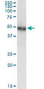 NR2F1 Monoclonal Antibody (1A4)