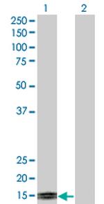 TFF1 Antibody in Western Blot (WB)