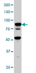 TFRC Monoclonal Antibody (1E6)