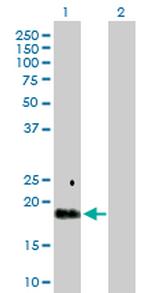 TGFA Antibody in Western Blot (WB)